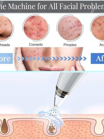 Vacuum Blackhead Remover Cleaner