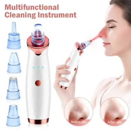 Vacuum Blackhead Remover for Face Pores and Black Spots