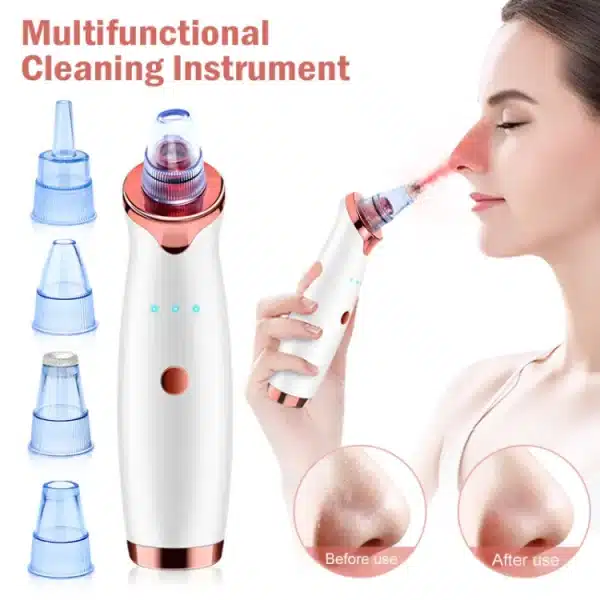 Vacuum Blackhead Remover for Face Pores and Black Spots